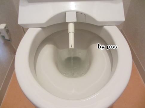 ウオッシュレットノズルの写真01