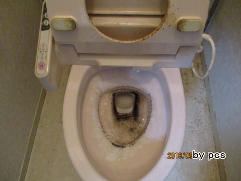 便器の尿石の写真03