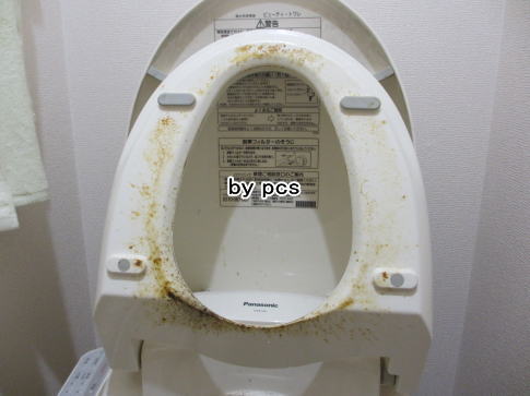 トイレ便座カバーについた尿石汚れの写真01